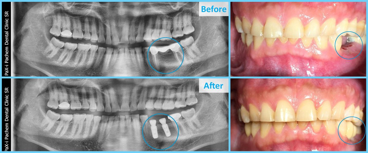 Dr. Chour Darith - Dr. Chour Darith