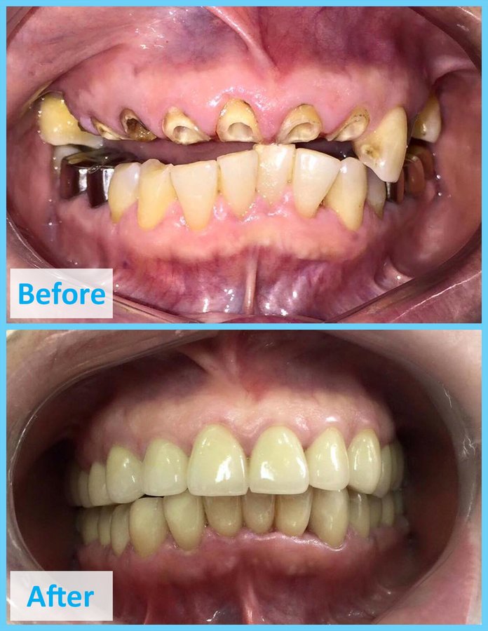 Dr. Chour Darith - Dr. Chour Darith