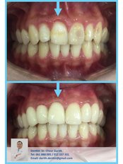 Dr. Chour Darith - Dr. Chour Darith