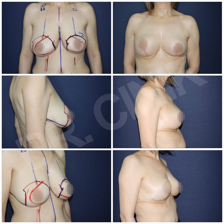 Dr. Cinik Plastic Surgery - Dr. Cinik Plastic Surgery