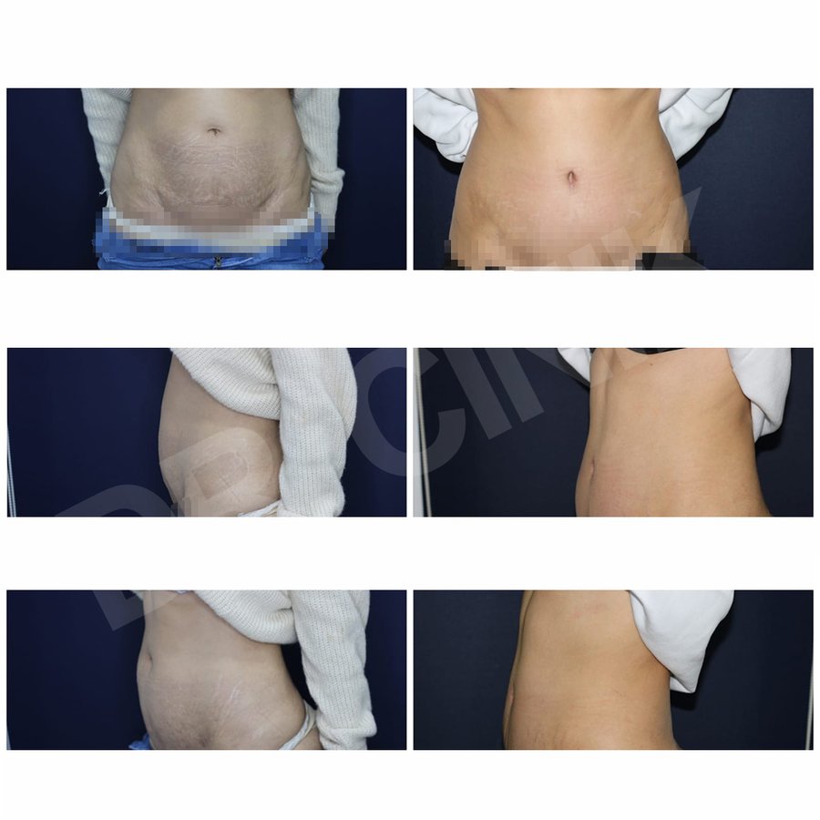 Dr. Cinik Plastic Surgery - Dr. Cinik Plastic Surgery