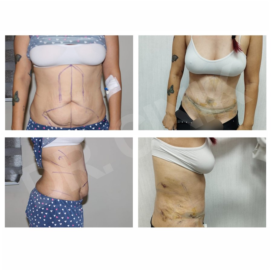 Dr. Cinik Plastic Surgery - Dr. Cinik Plastic Surgery