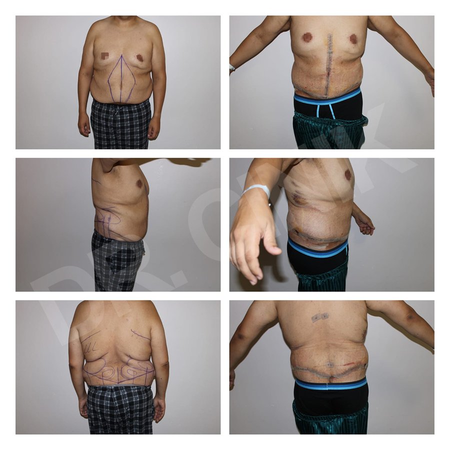 Dr. Cinik Plastic Surgery - Dr. Cinik Plastic Surgery