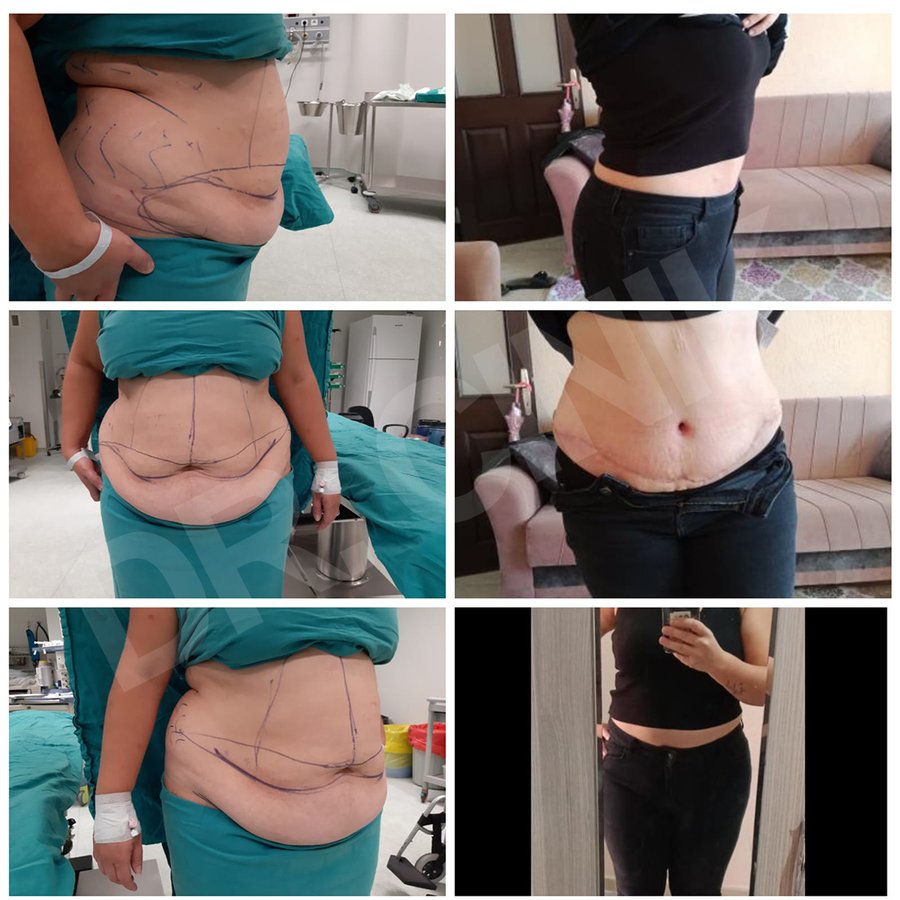 Dr. Cinik Plastic Surgery - Dr. Cinik Plastic Surgery