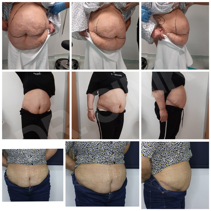 Dr. Cinik Plastic Surgery - Dr. Cinik Plastic Surgery