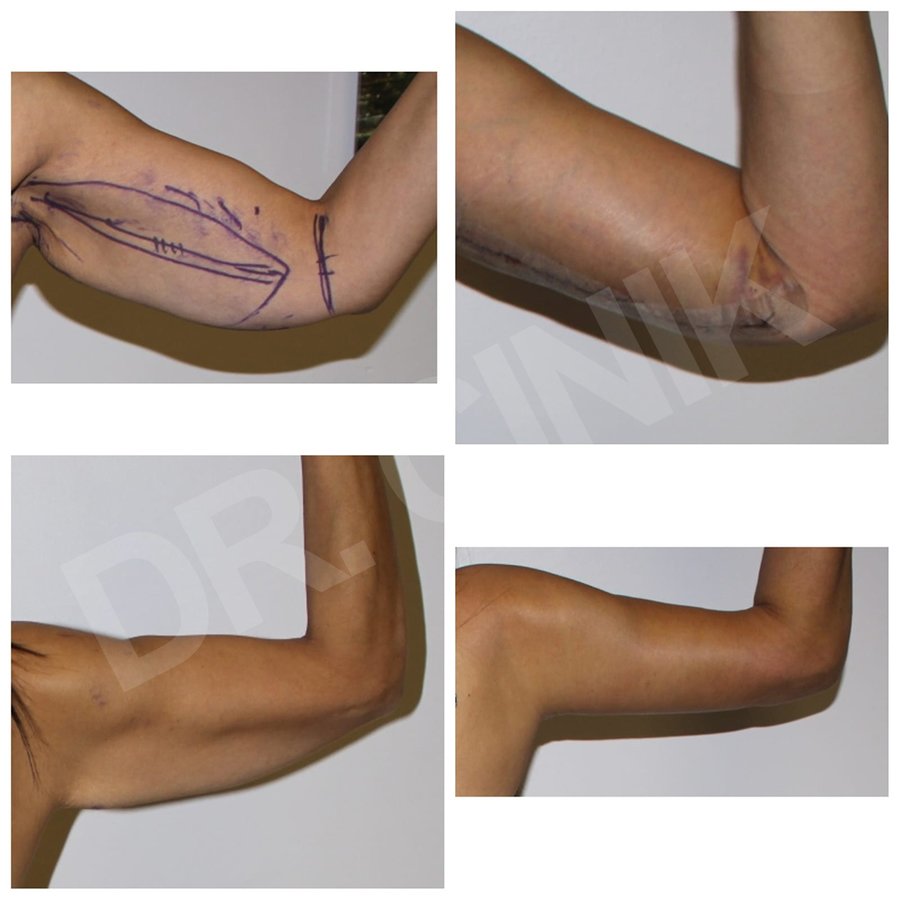 Dr. Cinik Plastic Surgery - Dr. Cinik Plastic Surgery