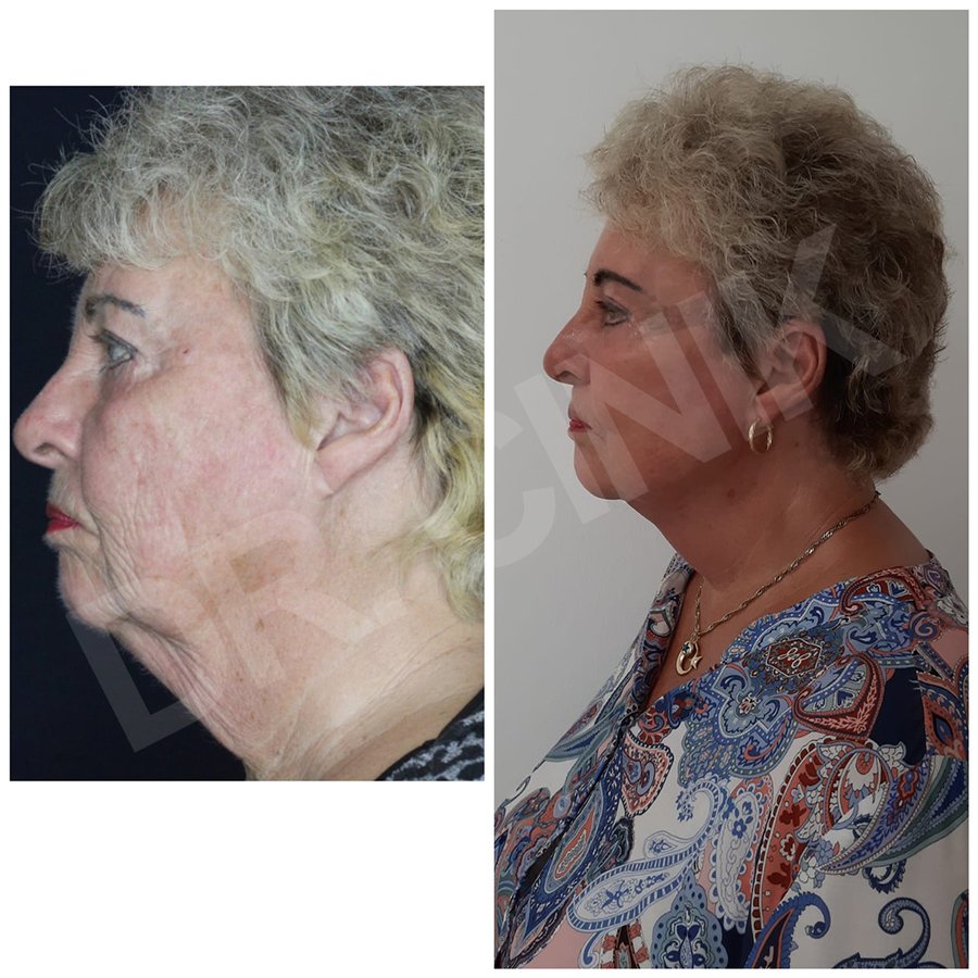 Dr. Cinik Plastic Surgery - Dr. Cinik Plastic Surgery