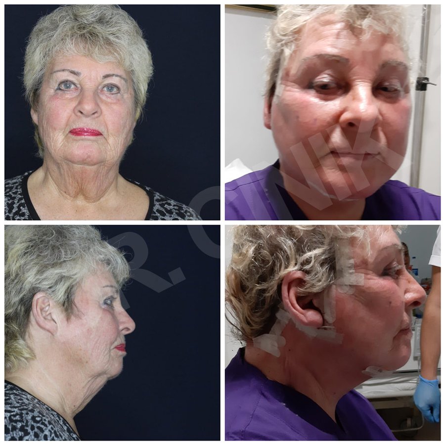 Dr. Cinik Plastic Surgery - Dr. Cinik Plastic Surgery