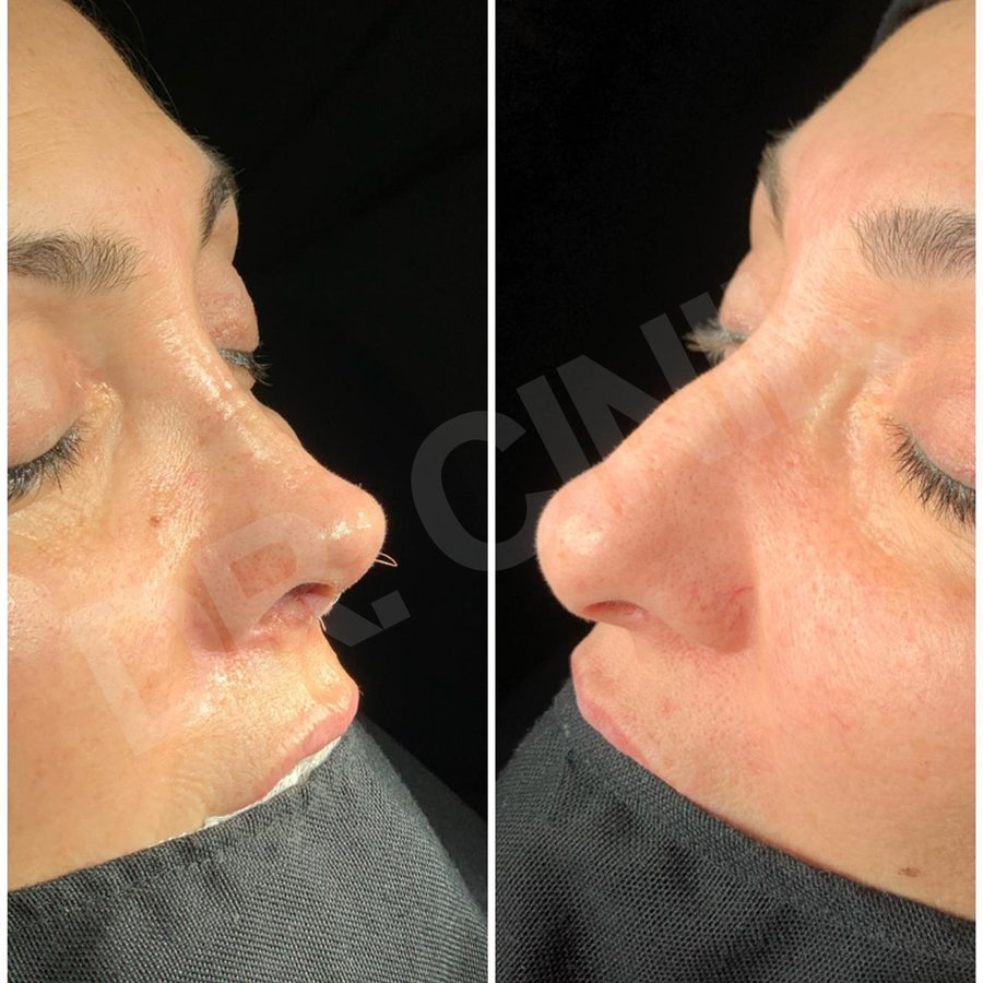 Dr. Cinik Plastic Surgery - Dr. Cinik Plastic Surgery