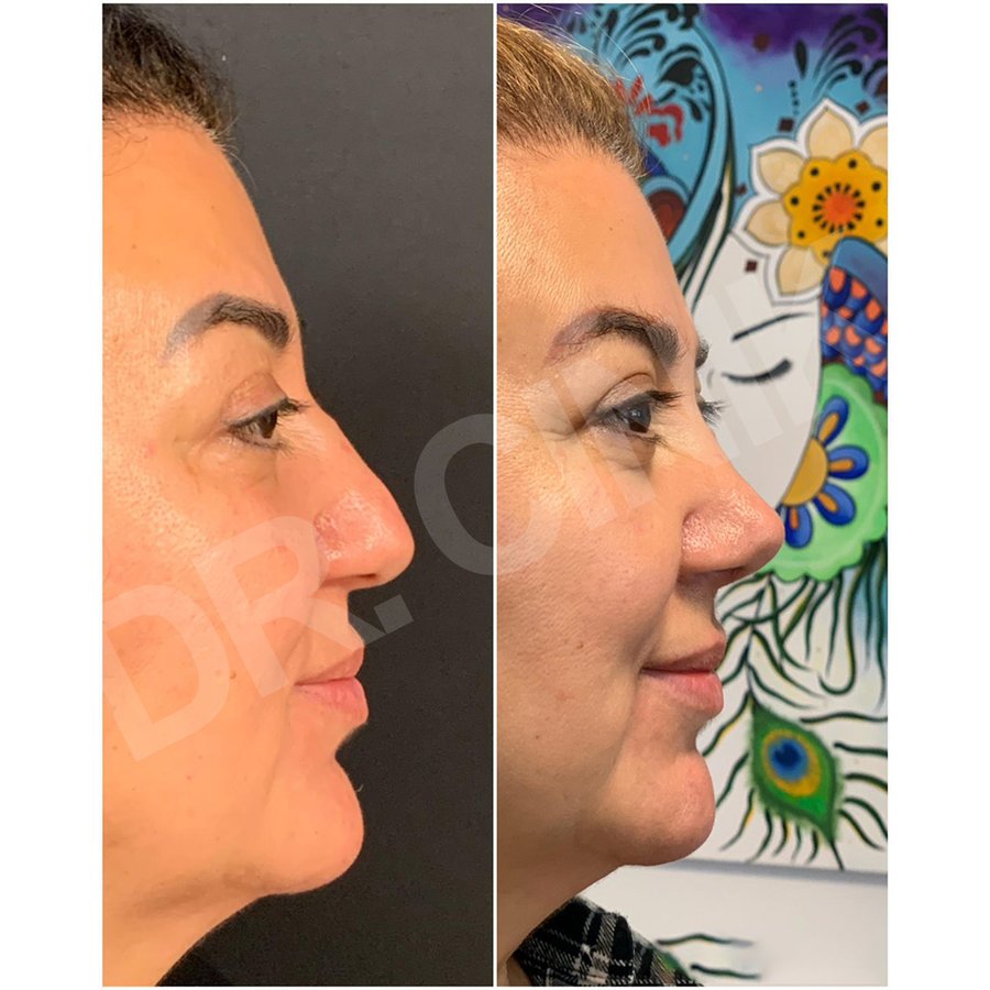 Dr. Cinik Plastic Surgery - Dr. Cinik Plastic Surgery