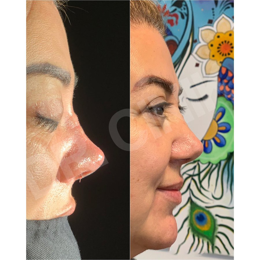 Dr. Cinik Plastic Surgery - Dr. Cinik Plastic Surgery