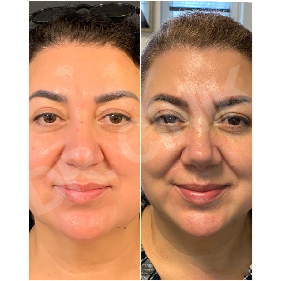 Dr. Cinik Plastic Surgery - Dr. Cinik Plastic Surgery