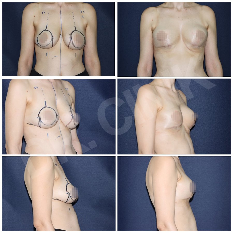 Dr. Cinik Plastic Surgery - Dr. Cinik Plastic Surgery