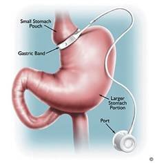 Dr. Costa Karihaloo Gastrointestinal Surgeon - Dr. Costa Karihaloo Gastrointestinal Surgeon