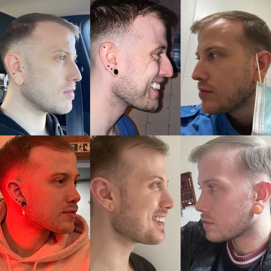 Dr. Dario Rochira - Dr. Dario Rochira