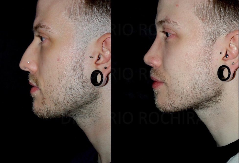 Dr. Dario Rochira - Dr. Dario Rochira