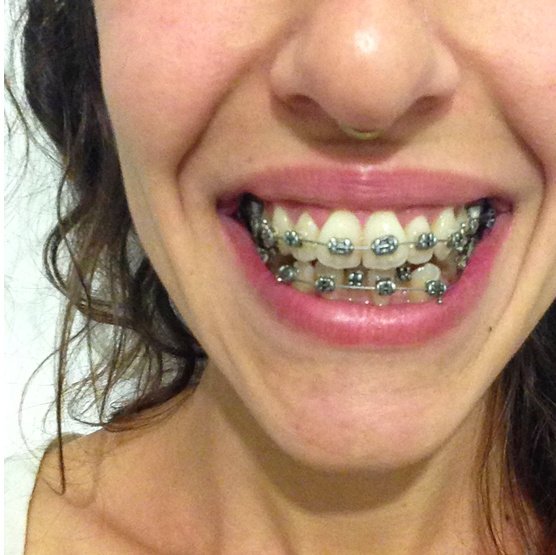 Dr. Debra Katz - Dr. Debra Katz