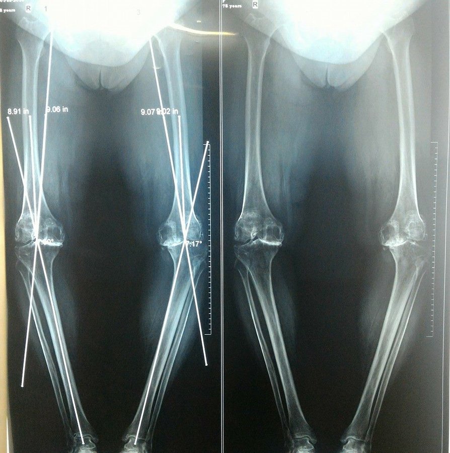 Dr Deepak Inamdar's Orthopedic and Joint Replacement Center - Dr Deepak Inamdar's Orthopedic and Joint Replacement Center