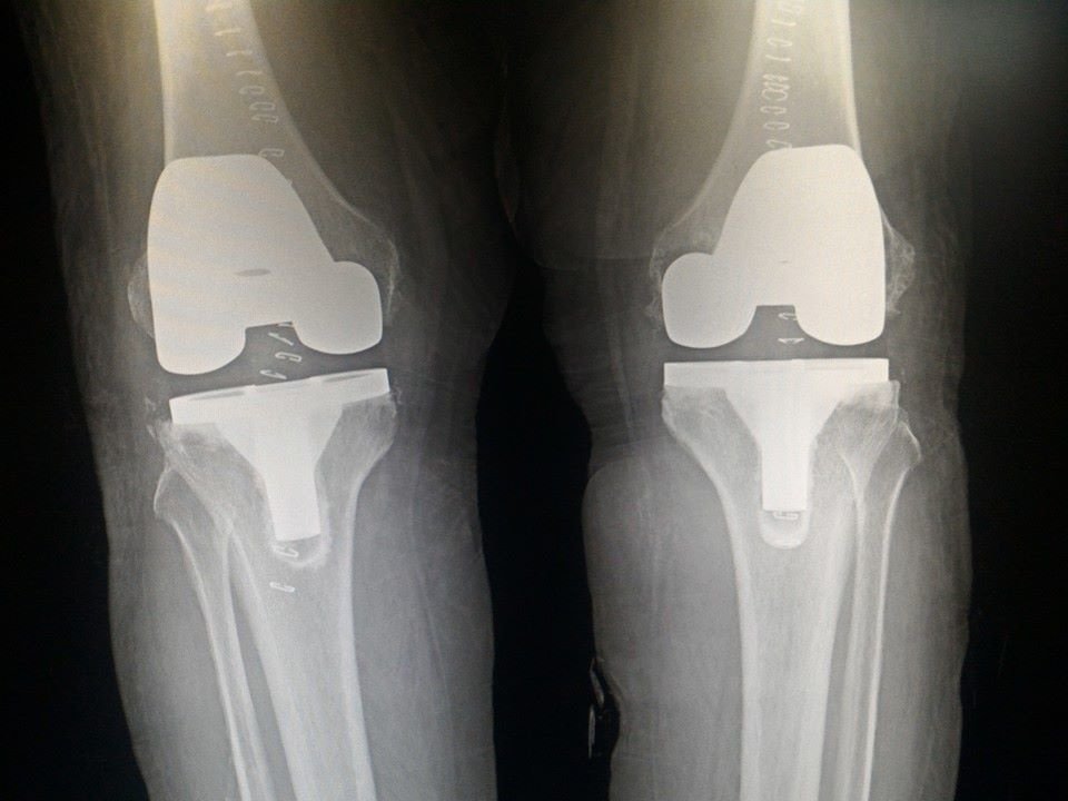 Dr Deepak Inamdar's Orthopedic and Joint Replacement Center - Dr Deepak Inamdar's Orthopedic and Joint Replacement Center