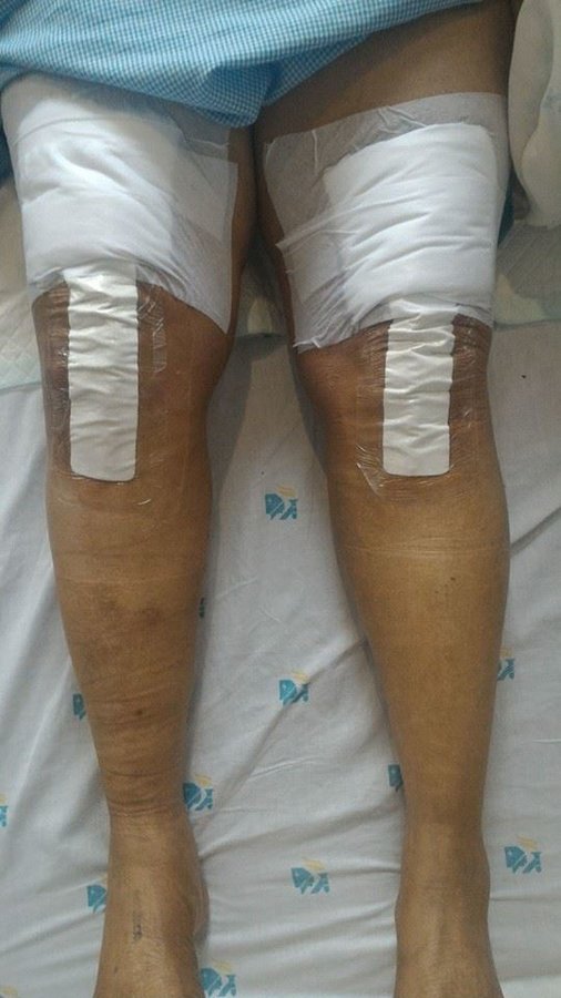 Dr Deepak Inamdar's Orthopedic and Joint Replacement Center - Dr Deepak Inamdar's Orthopedic and Joint Replacement Center