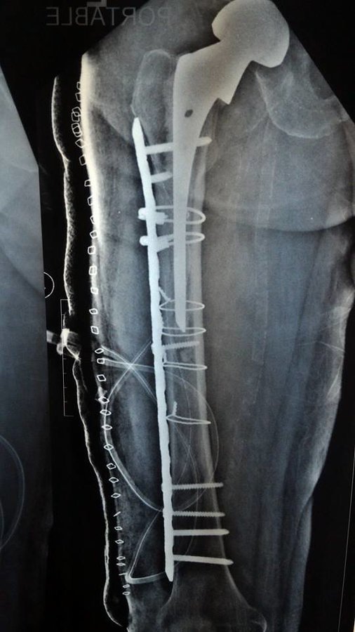 Dr Deepak Inamdar's Orthopedic and Joint Replacement Center - Dr Deepak Inamdar's Orthopedic and Joint Replacement Center