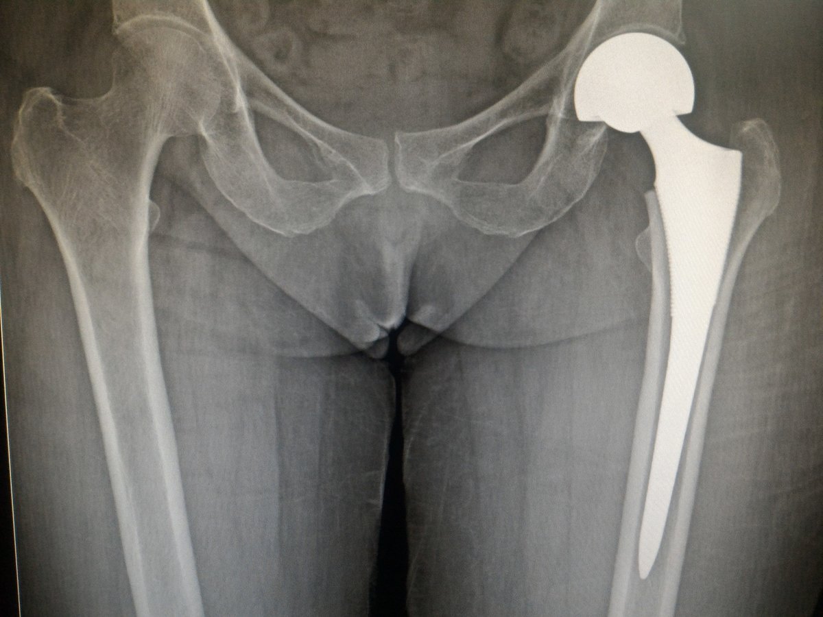 Dr Deepak Inamdar's Orthopedic and Joint Replacement Center - Dr Deepak Inamdar's Orthopedic and Joint Replacement Center