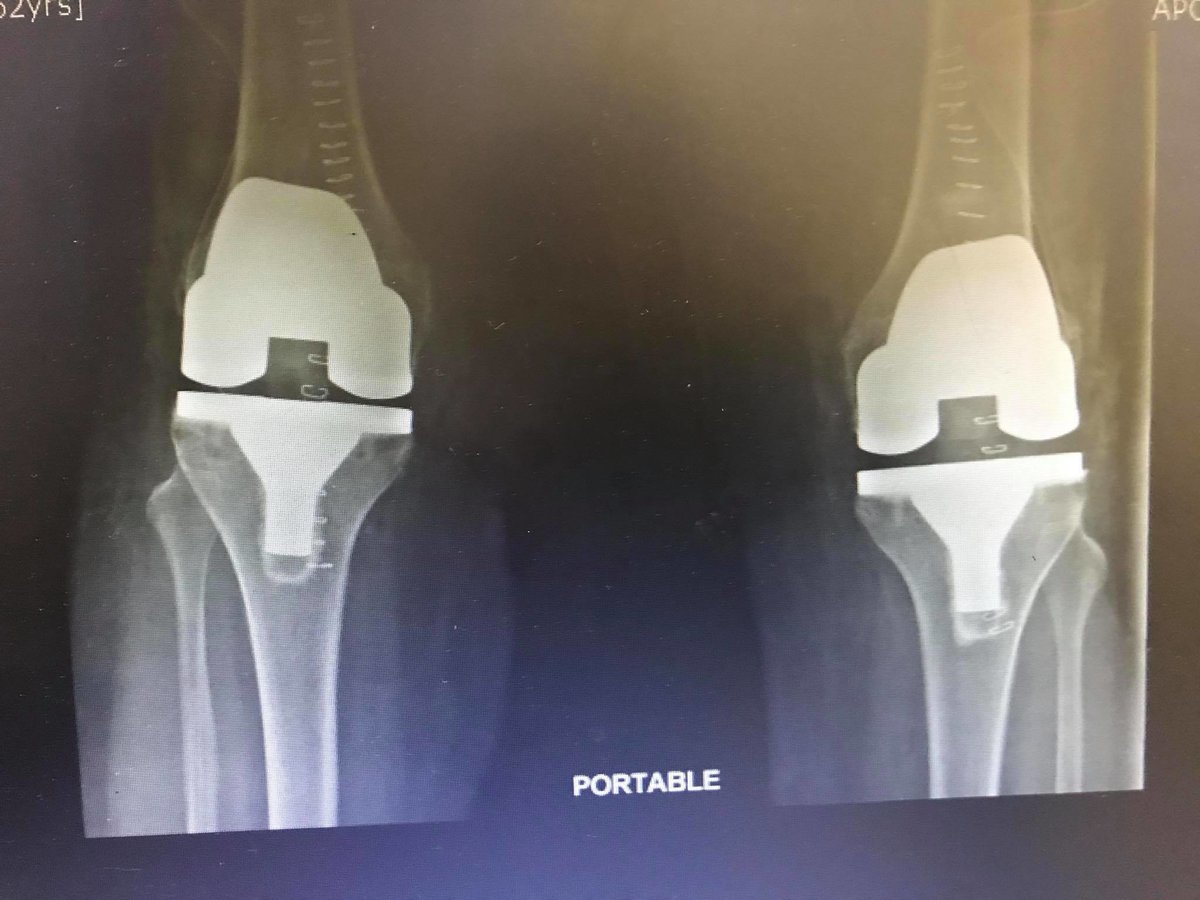 Dr Deepak Inamdar's Orthopedic and Joint Replacement Center - Dr Deepak Inamdar's Orthopedic and Joint Replacement Center