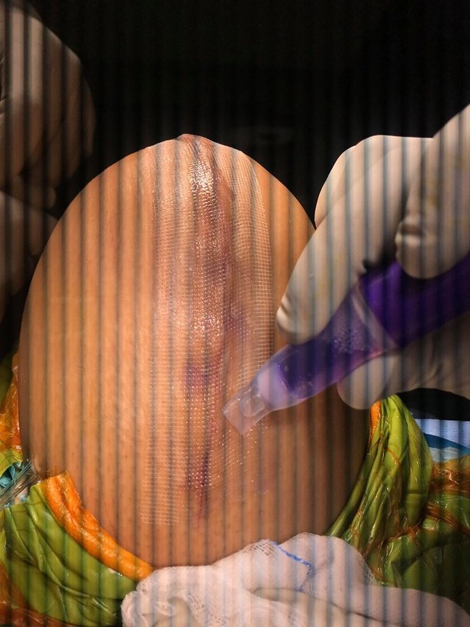 Dr Deepak Inamdar's Orthopedic and Joint Replacement Center - Dr Deepak Inamdar's Orthopedic and Joint Replacement Center