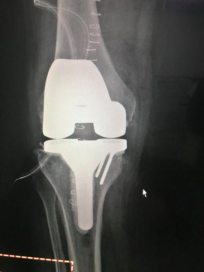 Dr Deepak Inamdar's Orthopedic and Joint Replacement Center - Dr Deepak Inamdar's Orthopedic and Joint Replacement Center