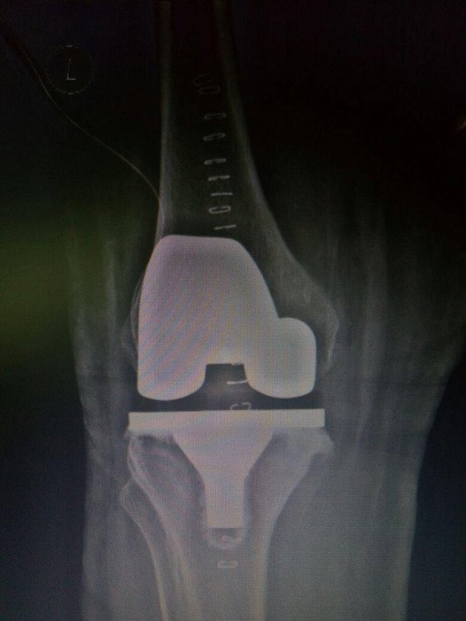 Dr Deepak Inamdar's Orthopedic and Joint Replacement Center - Dr Deepak Inamdar's Orthopedic and Joint Replacement Center