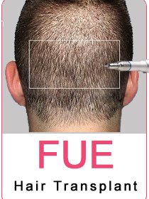 Dr. Devesh Aggarwal - Dr. Devesh Aggarwal