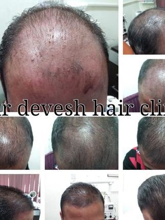 Dr. Devesh Aggarwal - Dr. Devesh Aggarwal