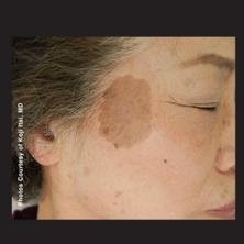 الدكتور ديليك باداتلي إستيتيك، Plastik ve Rekonstrktif Cerrahi Uzman El Cerrahisi Yandal Uzman - Dr. Dilek Bağdatlı Estetik, Plastik ve Rekonstrüktif Cerrahi Uzmanı El Cerrahisi Yandal Uzmanı