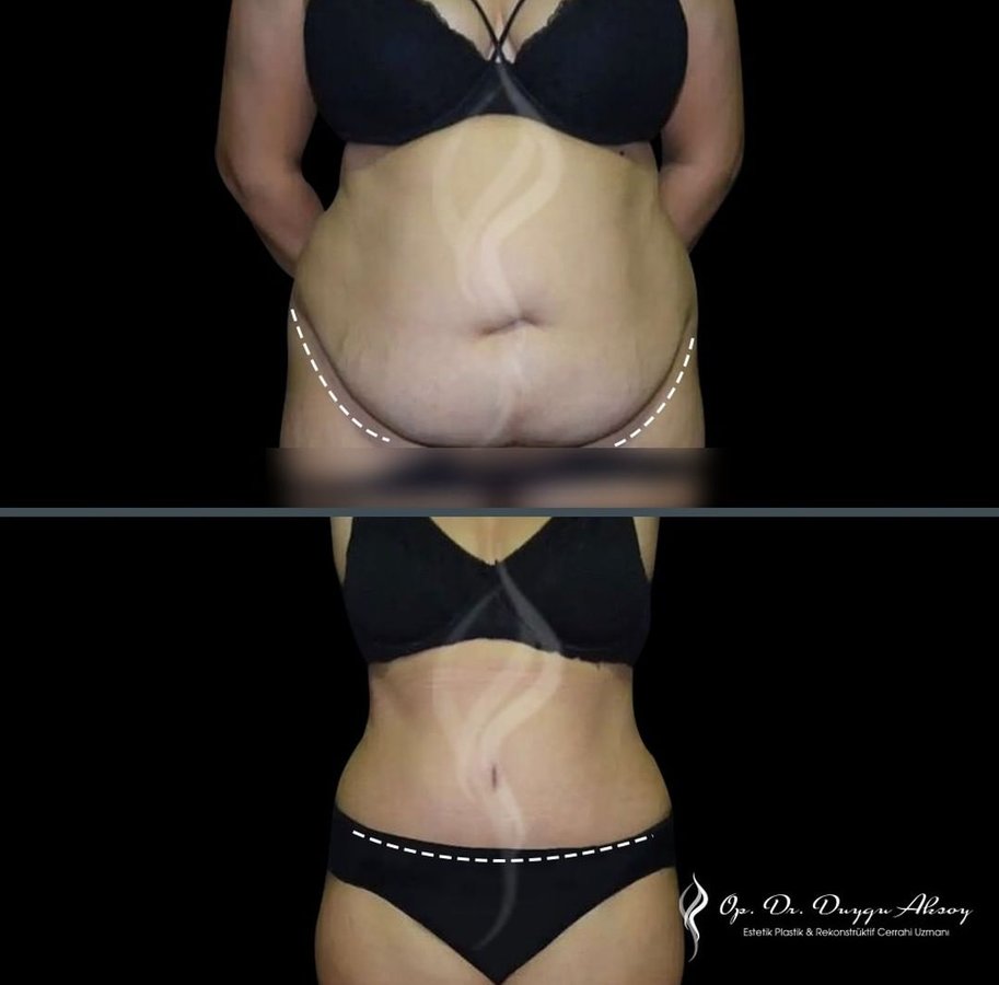 Dr Duygu Aksoy Clinic - Dr Duygu Aksoy Clinic