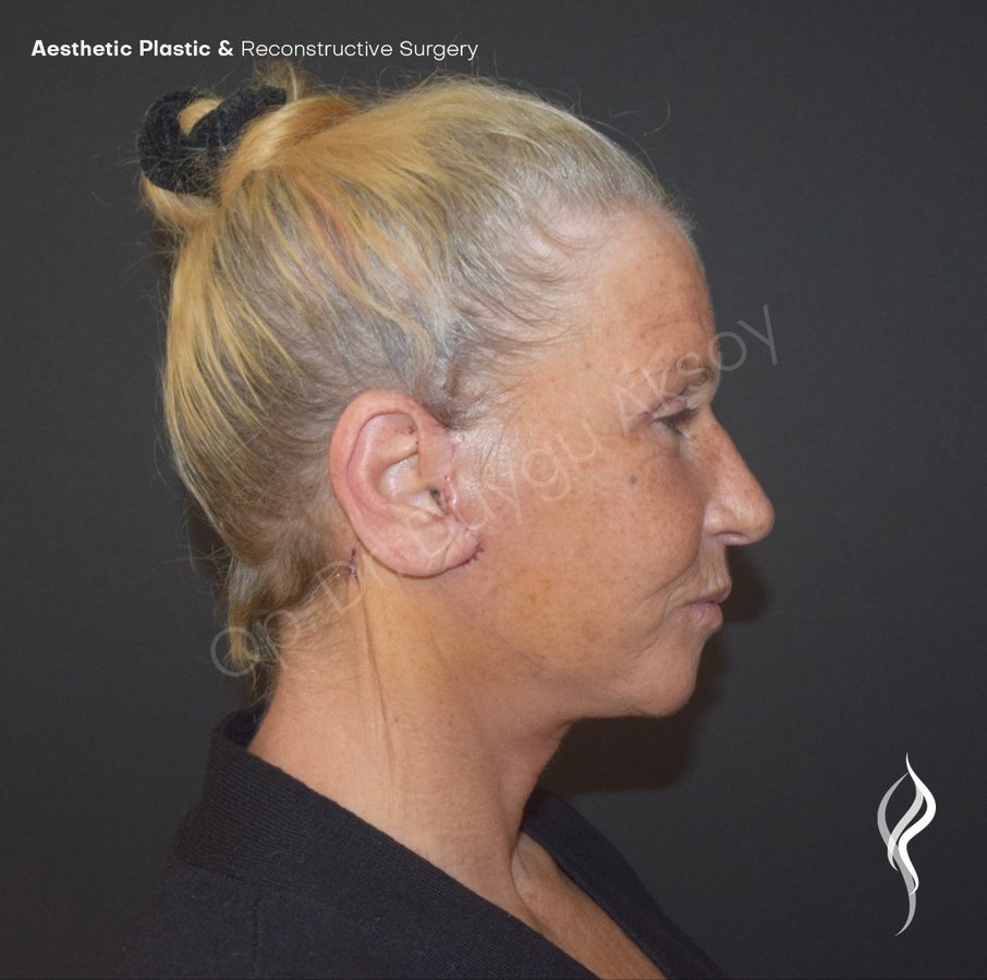 Dr Duygu Aksoy Clinic - Dr Duygu Aksoy Clinic