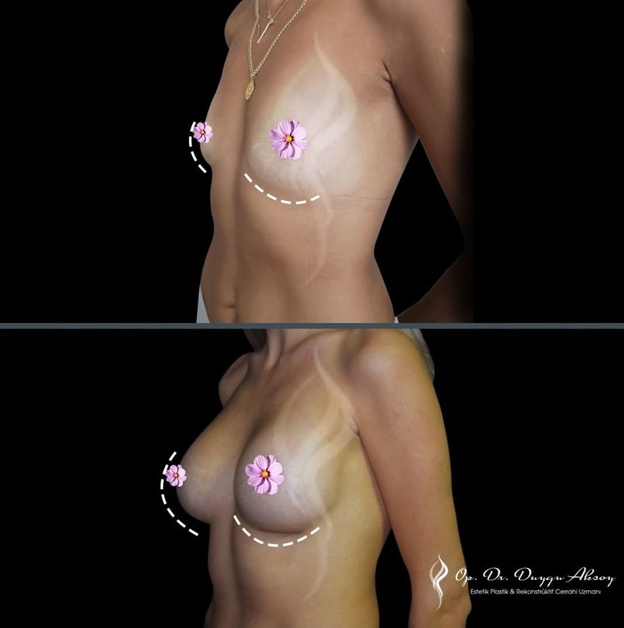 Dr Duygu Aksoy Clinic - Dr Duygu Aksoy Clinic