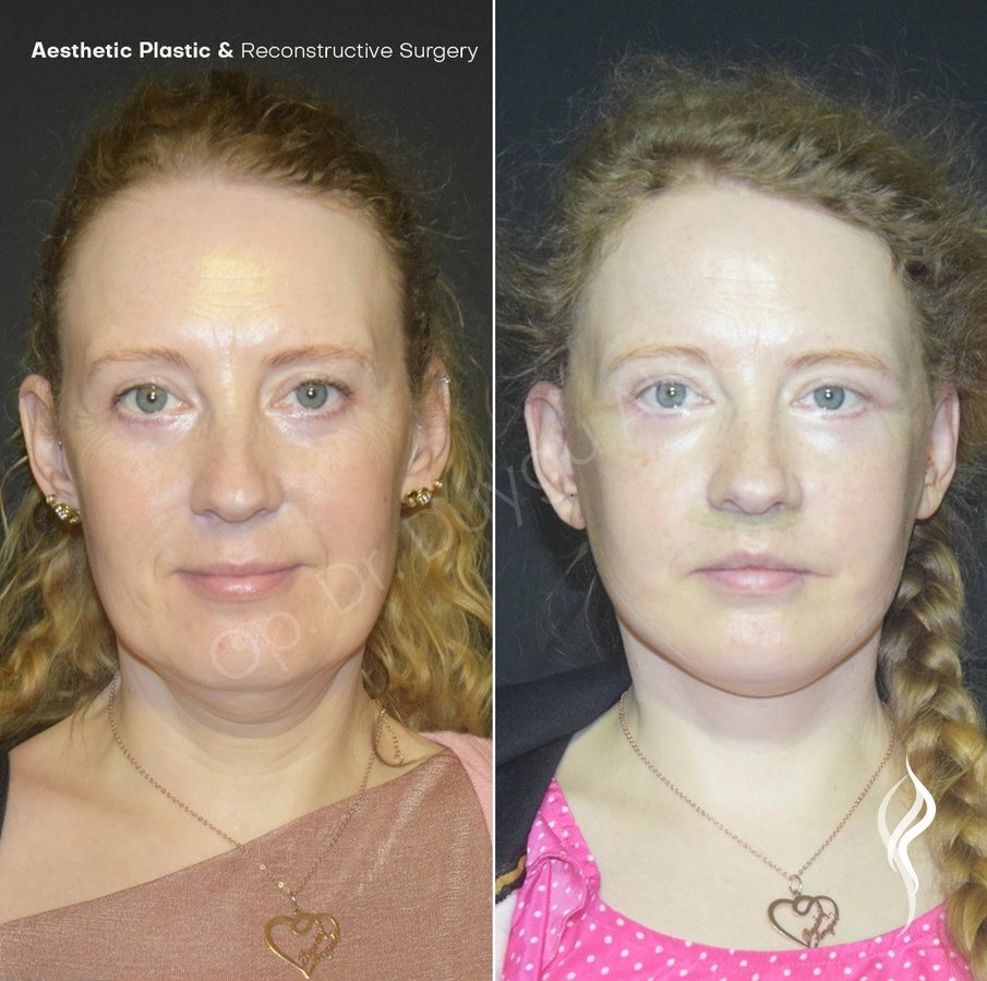 Dr Duygu Aksoy Clinic - Dr Duygu Aksoy Clinic