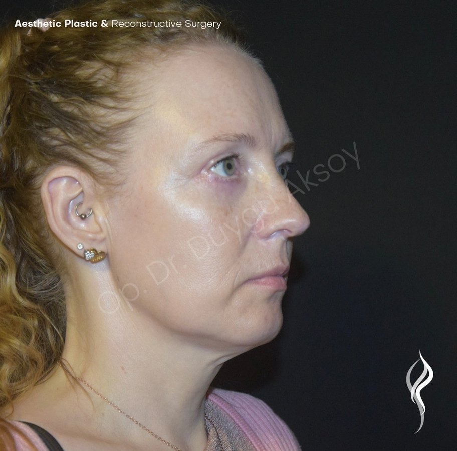 Dr Duygu Aksoy Clinic - Dr Duygu Aksoy Clinic