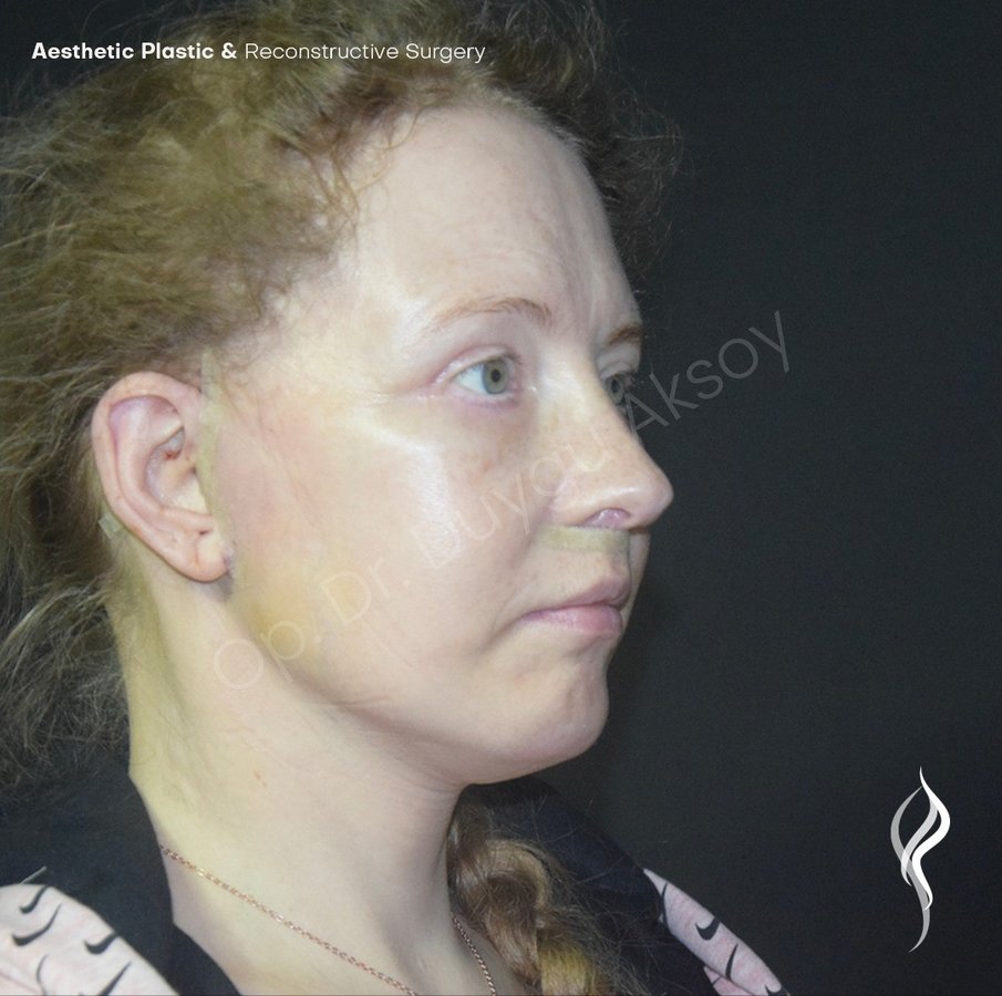 Dr Duygu Aksoy Clinic - Dr Duygu Aksoy Clinic