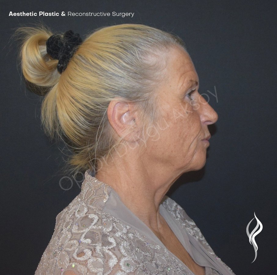 Dr Duygu Aksoy Clinic - Dr Duygu Aksoy Clinic
