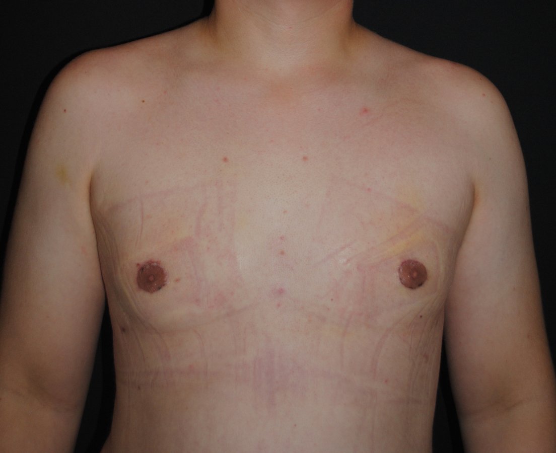 Dr. Eduardo Mejia - Dr. Eduardo Mejia