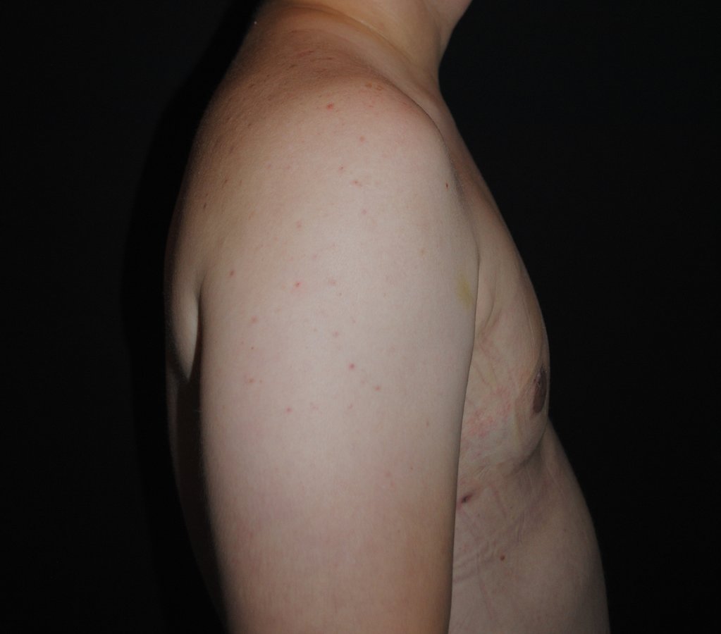 Dr. Eduardo Mejia - Dr. Eduardo Mejia