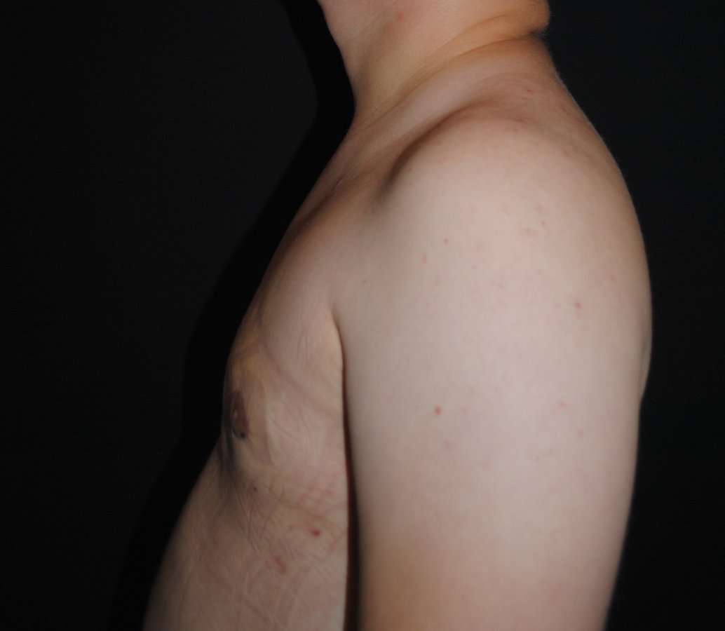 Dr. Eduardo Mejia - Dr. Eduardo Mejia