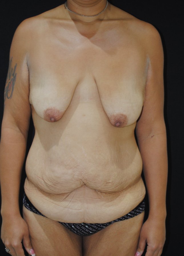 Dr. Eduardo Mejia - Dr. Eduardo Mejia