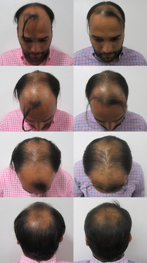 Dr. Eduardo Mejia - Dr. Eduardo Mejia