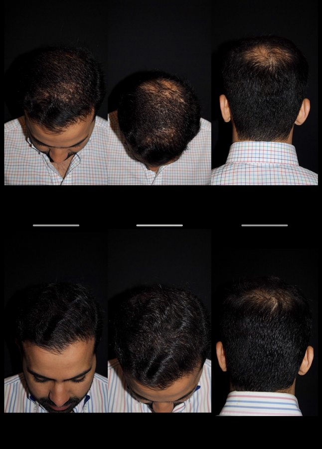 Dr. Eduardo Mejia - Dr. Eduardo Mejia