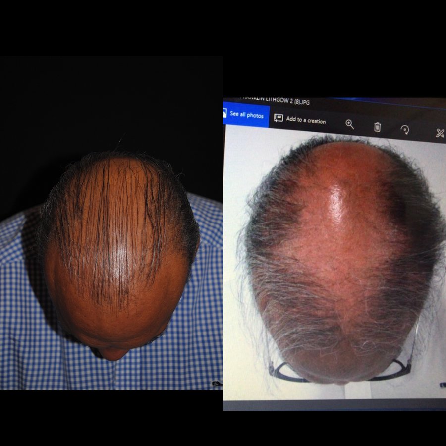 Dr. Eduardo Mejia - Dr. Eduardo Mejia