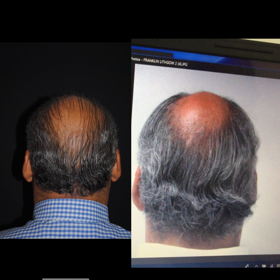 Dr. Eduardo Mejia - Dr. Eduardo Mejia