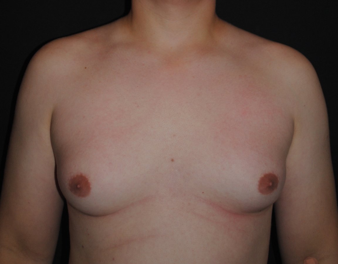 Dr. Eduardo Mejia - Dr. Eduardo Mejia