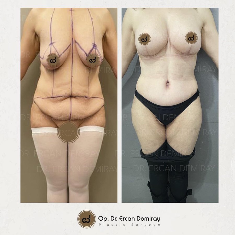 Dr Ercan Demiray MD, Aesthetic and Plastic Surgeon - Dr Ercan Demiray MD, Aesthetic and Plastic Surgeon